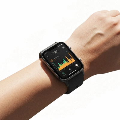 Close-up on a person's wrist wearing a sleek continuous glucose monitor (CGM) or smartwatch, integrated with a smartphone app displaying health data